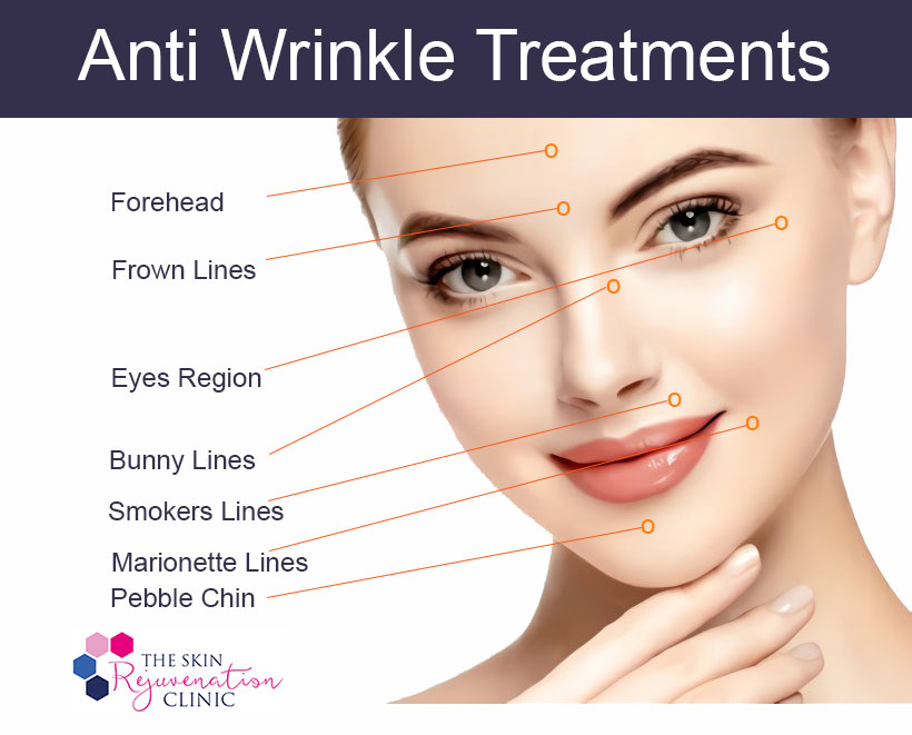 Anti Wrinkle Treatments